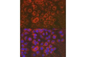 Immunofluorescence analysis of Huh7 cells using Sorbitol Dehydrogenase Rabbit pAb (ABIN3022961, ABIN3022962, ABIN3022963, ABIN1513552 and ABIN6219319) at dilution of 1:50 (40x lens).