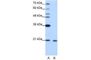 RBM8A antibody used at 1. (RBM8A Antikörper  (N-Term))