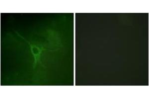 Immunofluorescence analysis of COS7 cells, using GFAP (Phospho-Ser38) Antibody. (GFAP Antikörper  (pSer38))