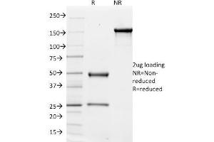 SDS-PAGE Analysis Purified CD51 / Integrin 'V Mouse Monoclonal Antibody (ITGAV/1610).