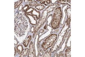 Immunohistochemical staining of human kidney with SEC24B polyclonal antibody  shows strong cytoplasmic positivity in cells in tubules at 1:200-1:500 dilution.