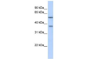 RAB40B antibody used at 1 ug/ml to detect target protein.
