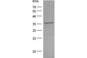 Western Blotting (WB) image for Fructose-1,6-Bisphosphatase 1 (FBP1) (AA 199-338) protein (His-IF2DI Tag) (ABIN7123007) (FBP1 Protein (AA 199-338) (His-IF2DI Tag))