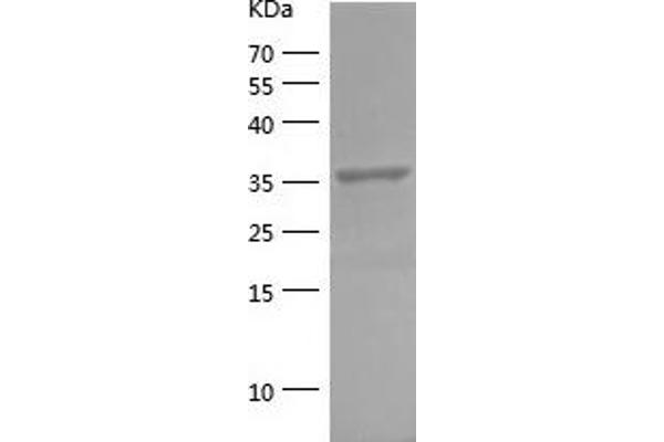 FBP1 Protein (AA 199-338) (His-IF2DI Tag)