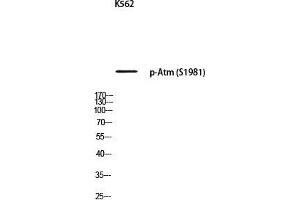 Western Blot (WB) analysis of K562 using p-Atm (S1981) antibody.