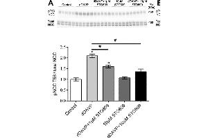 Ex vivo studies on isolated cortical tubules from mouse kidney highlight a role for CAMKK and PI3K in VP signaling in mpkDCT cells. (SLC12A3 Antikörper  (AA 74-95))