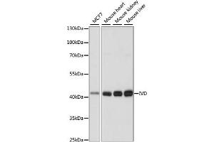 Western blot analysis of extracts of various cell lines, using IVD antibody (ABIN7268031) at 1:1000 dilution. (IVD Antikörper  (AA 33-200))