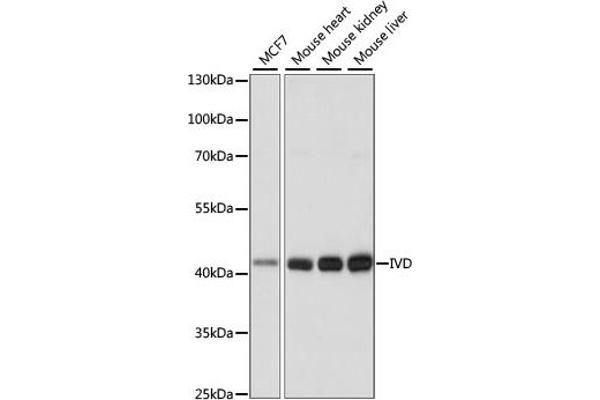 IVD Antikörper  (AA 33-200)