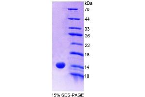 SDS-PAGE analysis of Human S100A9 Protein. (S100A9 Protein)