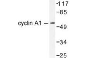 Image no. 2 for anti-Cyclin A1 (CCNA1) antibody (ABIN265378)