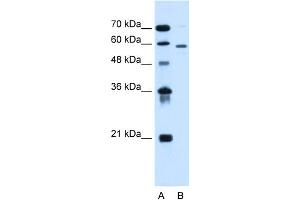 WB Suggested Anti-ALG11 Antibody Titration:  0. (ALG11 Antikörper  (C-Term))