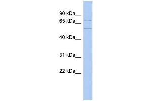WB Suggested Anti-ZNF285A Antibody Titration:  0. (ZNF285 Antikörper  (Middle Region))