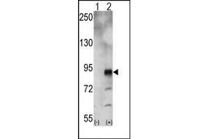 Western blot analysis of EphA5 (arrow) using rabbit polyclonal EphA5 Antibody. (EPH Receptor A5 Antikörper)