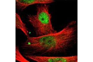 Immunofluorescence staining of U-251MG cell line with antibody shows positivity in nucleoplasm(green). (PBX1 Antikörper)