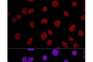 Confocal immunofluorescence analysis of U2OS cells using XRCC5 Polyclonal Antibody at dilution of 1:100. (XRCC5 Antikörper)