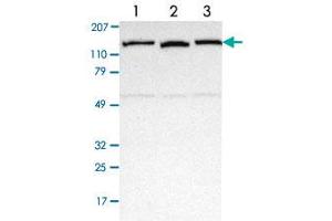 Western blot analysis of Lane 1: Human cell line RT-4 Lane 2: Human cell line EFO-21 Lane 3: Human cell line A-431 with NEK9 polyclonal antibody  at 1:250-1:500 dilution. (NEK9 Antikörper)