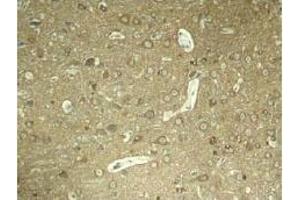 Image no. 3 for anti-Microtubule-Associated Protein tau (MAPT) (pSer404) antibody (ABIN196810) (MAPT Antikörper  (pSer404))