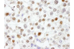 Immunohistochemistry (IHC) image for anti-Flap Structure-Specific Endonuclease 1 (FEN1) (AA 250-300) antibody (ABIN7448564) (FEN1 Antikörper  (AA 250-300))