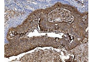 IHC analysis of NSF using anti-NSF antibody (ABIN7601630). (NSF Antikörper  (AA 4-636))