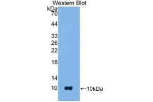 Detection of Recombinant S100B, Mouse using Polyclonal Antibody to S100 Calcium Binding Protein B (S100B) (S100B Antikörper  (AA 1-92))