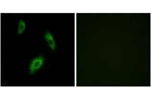 Immunofluorescence analysis of LOVO cells, using GPR174 Antibody.