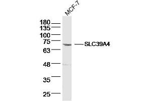 MCF-7 lysates probed with SLC39A4 Polyclonal Antibody, Unconjugated  at 1:300 dilution and 4˚C overnight incubation. (SLC39A4 Antikörper  (AA 281-380))