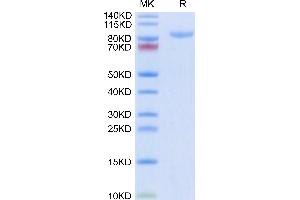 Human APLP2 on Tris-Bis PAGE under reduced condition.