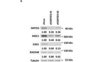 SMYD3 knockdown downregulates HR gene expressions. (MDC1 Antikörper)