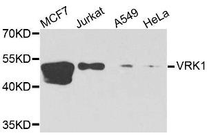 Western blot analysis of extracts of various cell lines, using VRK1 antibody. (VRK1 Antikörper  (AA 257-396))