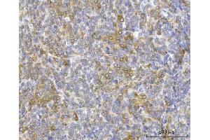 IHC analysis of RRS1 using anti-RRS1 antibody (ABIN7602918). (RRS1 Antikörper  (C-Term))