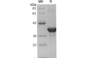 Western Blotting (WB) image for Chromogranin A (CHGA) (Active) protein (His tag) (ABIN7320927) (Chromogranin A Protein (CHGA) (His tag))