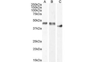 ABIN1590065 (0. (CKM Antikörper  (AA 258-270))