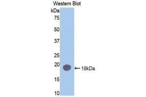 Detection of Recombinant F2, Rat using Polyclonal Antibody to Coagulation Factor II (F2) (Prothrombin Antikörper  (AA 201-323))