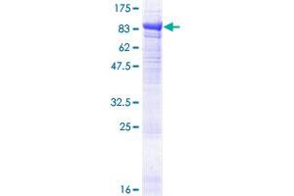 EPM2AIP1 Protein (AA 1-607) (GST tag)