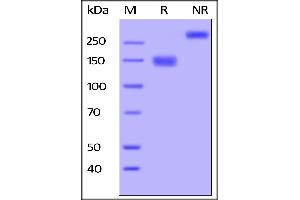 SDS-PAGE (SDS) image for Fms-Related Tyrosine Kinase 4 (FLT4) (AA 25-776) (Active) protein (Fc Tag) (ABIN5526635)