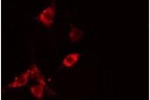 ABIN6275502 staining  HepG2 cells by IF/ICC. (RHOB Antikörper  (Internal Region))