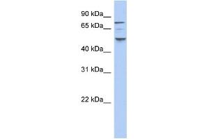 WB Suggested Anti-CSNK1E Antibody Titration: 0. (CK1 epsilon Antikörper  (N-Term))