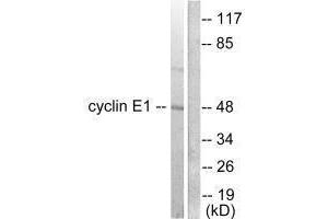 Western blot analysis of extracts from K562 cells, using Cyclin E1 antibody. (Cyclin E1 Antikörper)