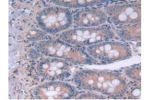 IHC-P analysis of Rat Intestine Tissue, with DAB staining. (IL12A Antikörper  (AA 23-215))