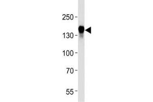 EGF Receptor antibody western blot analysis in HeLa lysate (EGFR Antikörper  (AA 1163-1191))