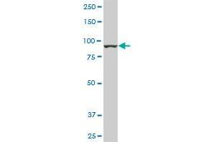 AMPD2 monoclonal antibody (M01), clone 2F5. (AMPD2 Antikörper  (AA 86-185))