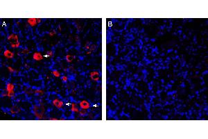 Expression of P2X3 in rat dorsal root ganglion.