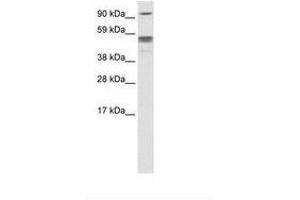 Image no. 2 for anti-Septin 4 (SEPT4) (N-Term) antibody (ABIN6735940) (Septin 4 Antikörper  (N-Term))