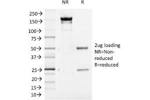 SDS-PAGE Analysis Purified Aurora B Mouse Monoclonal Antibody (AURKB/1521). (Aurora Kinase B Antikörper  (AA 89-251))