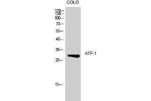 Western Blotting (WB) image for anti-Activating Transcription Factor 1 (AFT1) (Ser157) antibody (ABIN3173928) (AFT1 Antikörper  (Ser157))