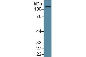 Western Blot; Sample: Human Lung lysate; Primary Ab: 1µg/ml Rabbit Anti-Human FAK Antibody Second Ab: 0. (FAK Antikörper  (AA 798-1041))