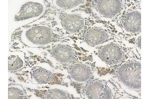 ABIN6257993 and ABIN6273660 at 1/100 staining human normal kidney tissue by IHC-P. (IL-6 Receptor Antikörper  (N-Term))