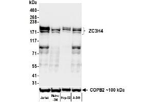 Western Blotting (WB) image for anti-Zinc Finger CCCH-Type Containing 4 (ZC3H4) (AA 1050-1100) antibody (ABIN7795758)