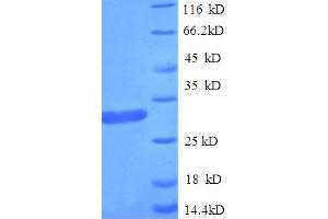 Suppressor of Cytokine Signaling 1 (SOCS1) (AA 1-211), (full length) protein (His tag)