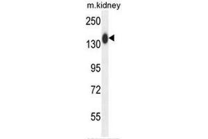COL19A1 Antibody (N-term) western blot analysis in mouse kidney tissue lysates (35µg/lane). (COL19A1 Antikörper  (Chain alpha 1, N-Term))
